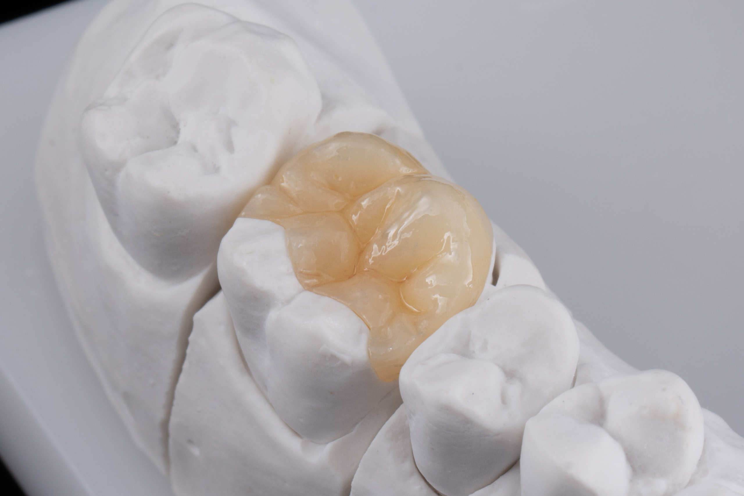 Modèle dentaire montrant une molaire naturelle et ses détails de structure, utilisée pour des soins dentaires et l’esthétique dentaire. Modèle dentaire montrant une molaire naturelle et ses détails de structure, utilisée pour des soins dentaires et l’esthétique dentaire.